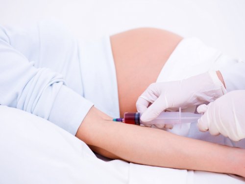 Ученые считают обязательным проведение скрининга преэклампсии у беременных