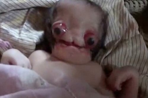 Младенец-инопланетянин  «Чужой» скончался в Индии