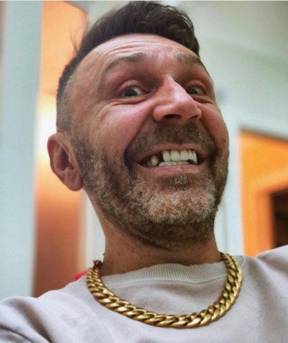 «Второй Овечкин»: У Сергея Шнурова выпал зуб, который он ставил в США за 250 тысяч долларов