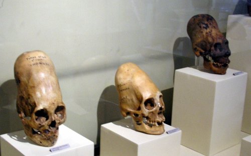 Археологи выяснили тайну вытянутых черепов