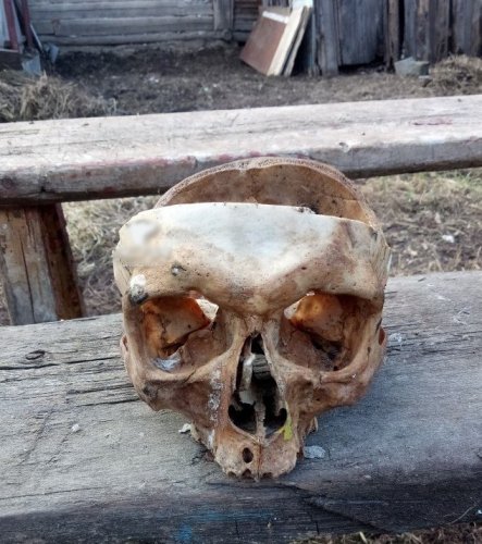 Житель Новосибирской области обнаружил человеческий череп у себя во дворе