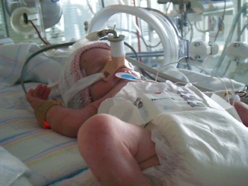 Беспроводные датчики могут контролировать здоровье больных младенцев