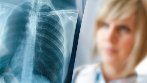 «Денег надо»: Учёные надеются окончательно победить туберкулёз к 2045 году