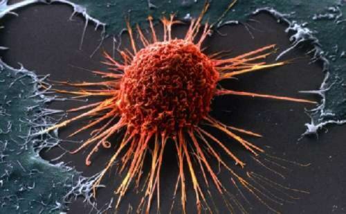 Рак можно предотвратить обычной профилактикой – Учёные