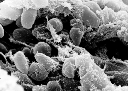 Во власти смерти: ученые обнаружили новые следы чумы в Европе