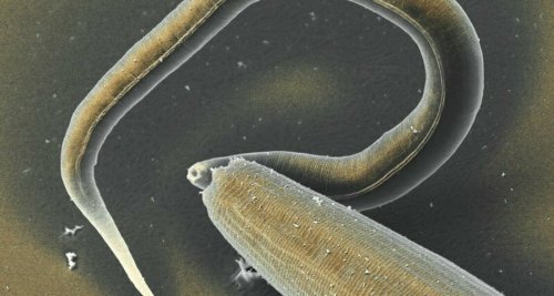 Учёные нашли новый способ уничтожения нематод, паразитирующих в организме человека