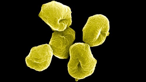 «Главная тайна эволюции раскрыта»: Микробиологи впервые вырастили клетки асгардархей