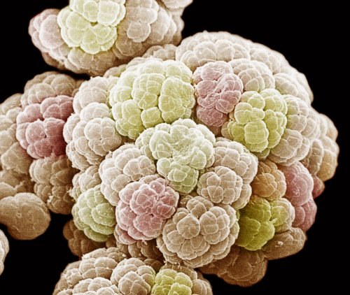 Биологам удалось вырастить неуловимый микроб, способный объяснить происхождение жизни