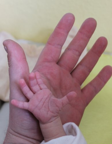 В Китае родился ребёнок с 31 пальцем