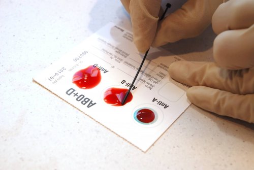 Эксперты установили, чем уникальна вторая группа крови