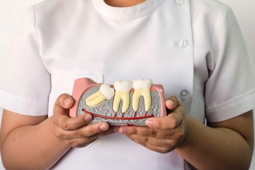 «Удалять или нет?»: Стоматологи рассказали всё о зубах мудрости