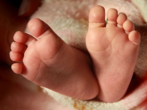 Ребёнок родился в Португалии совершенно без лица