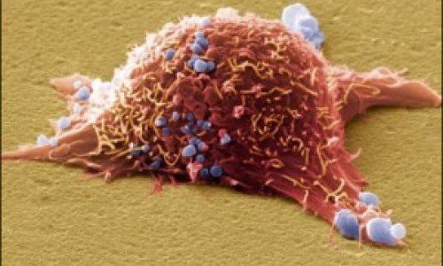 Гены смогут остановить рак: Учёные обнаружили их особенные модификации