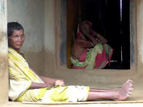 «Ведьма в Индии?»: Женщина имеет 12 пальцев на руках и 19 на ногах