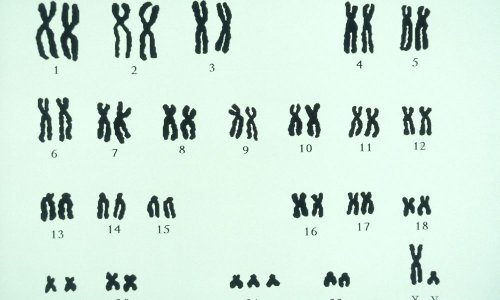 Ученые пришли  к новому пониманию хромосомы 21 и ее влиянию на синдром Дауна