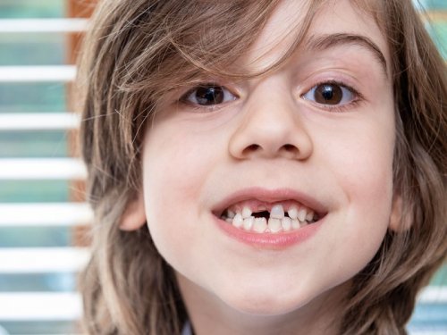 Стоматологи рассказали, когда ребёнку уже можно ставить коронку
