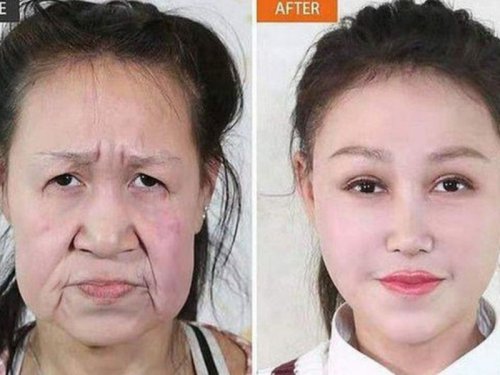 «Чудо в Китае»: Врачи вернули 15-летней девушке-старушке молодое лицо