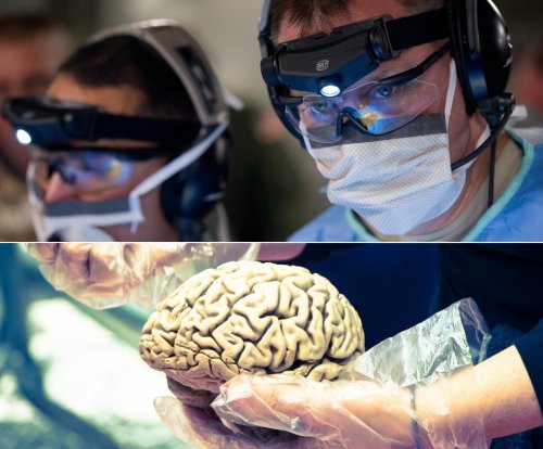 В России открыли беспрецедентный способ лечения опухоли мозга