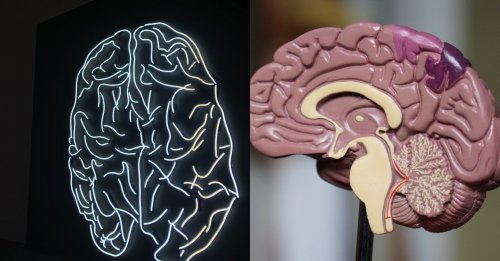 Нейробиологи продемонстрировали обратимость смерти мозга
