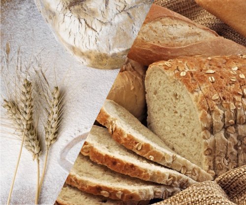Врач-диетолог Лизун опровергла миф о вреде хлеба из-за муки и глютена